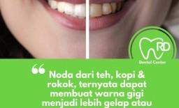 Cara Alami Membuat Gigi Putih dan Sehat